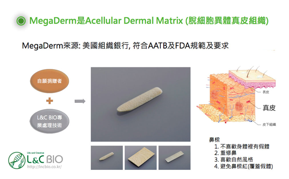 異體真皮MegaDerm /Acellular Dermal Matrix